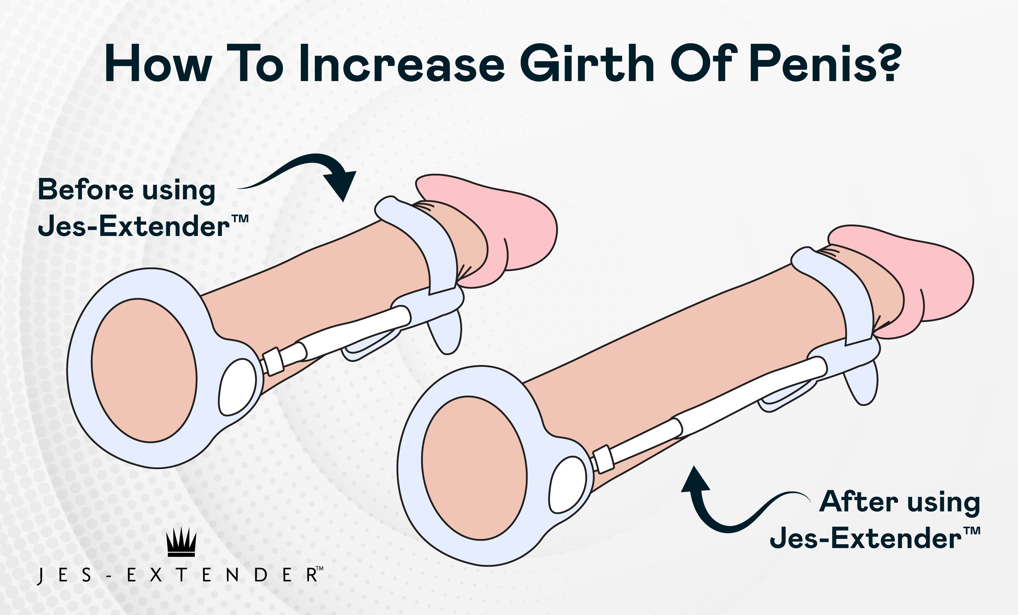 How To Increase Girth Of Penis